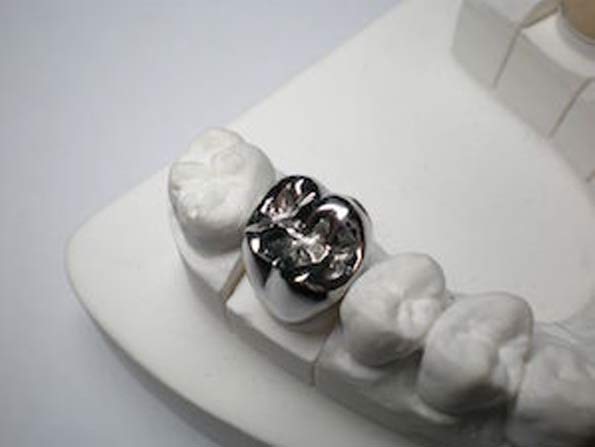 metal dental crown