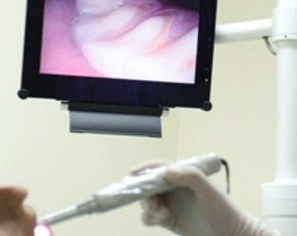 patient having dental instrument inserted into mouth, live feed of gums broadcast on nearby monitor