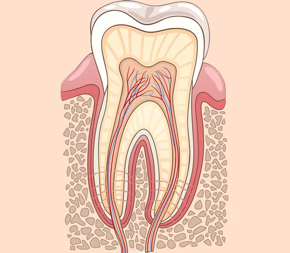 graphic depicting root canal