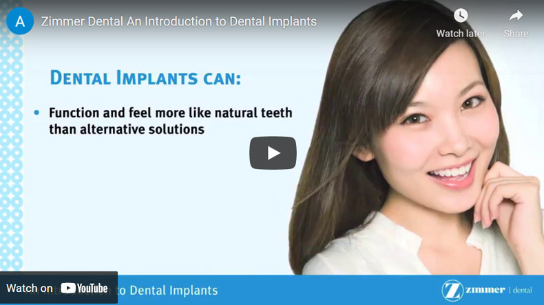 Image of Zimmer Dental An Introduction to Dental Implants Click to See Video