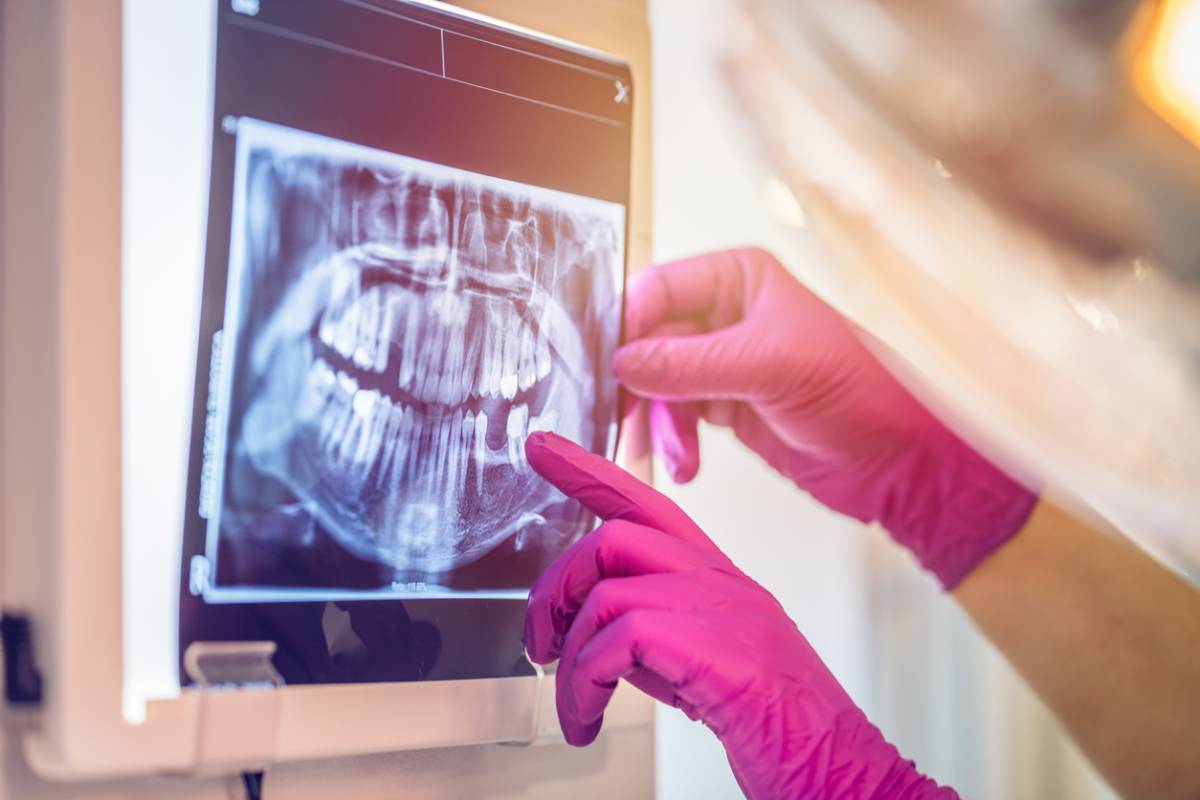 Are Dental X Rays Safe Pearl Dental Care Blog
