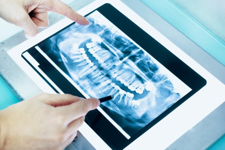 How Many Dental XRays are Safe Per Year? Pearl Dental Care