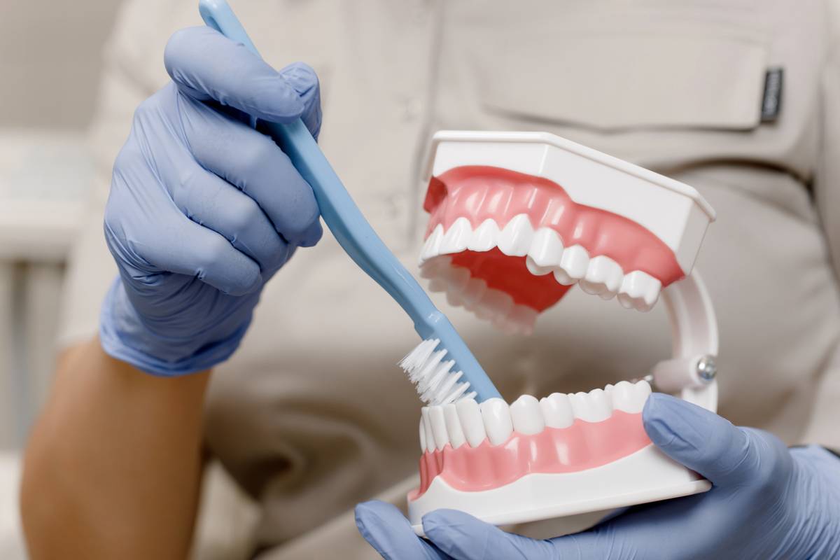 featured image for how to clean your dental veneers