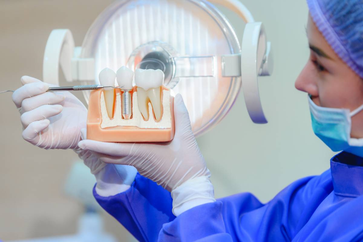 featured image for 10 common myths about dental implants