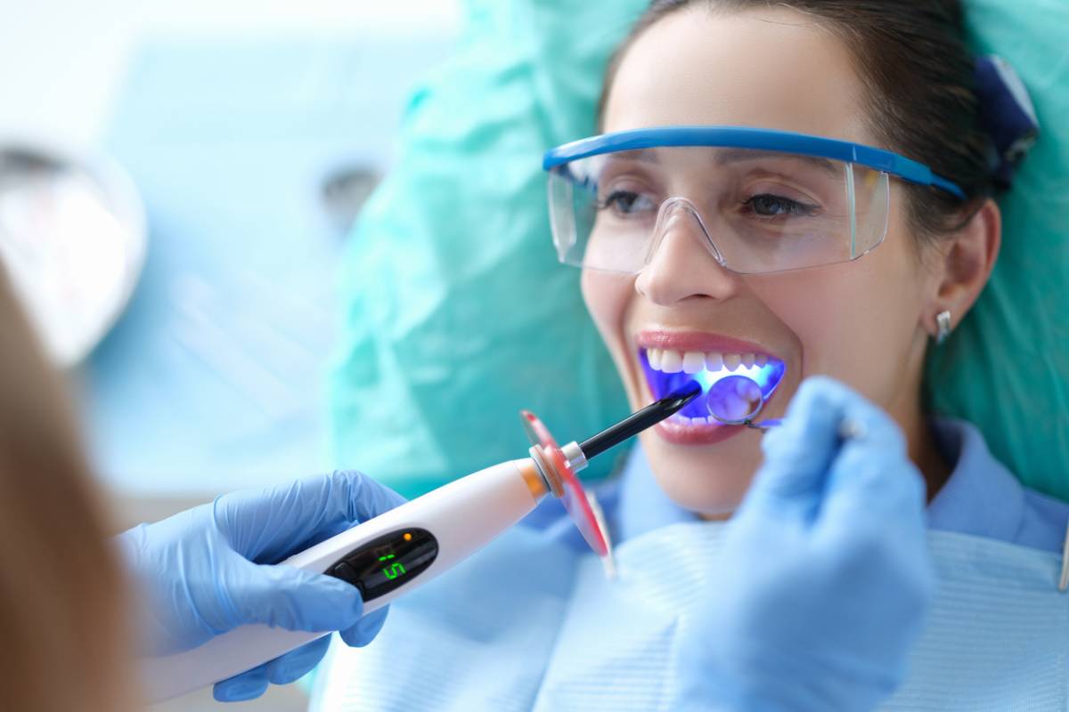featured image for what color is dental bonding