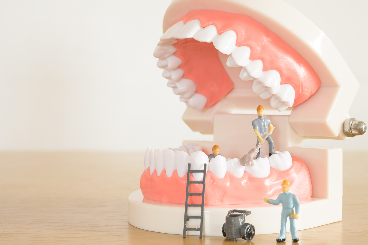The image shows miniature worker figurines cleaning a model of teeth to show the benefits of professional teeth cleaning.